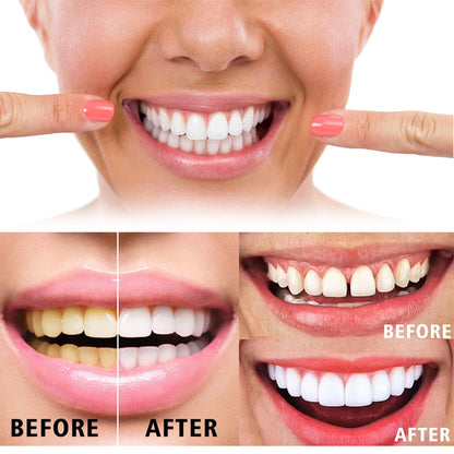 Jaysuing Tooth Gel For Tooth Cleaning Breath For Oral Cleaning Health & Beauty Health & Beauty Under 10 UniversalMaax https://www.cyberehub.com