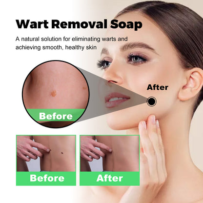 Skin Tag Removal Rubber Band, Remove Moles Remove Warts Face Neck Flesh Granule Body Cleansing Soap Health Eprolo https://www.cyberehub.com