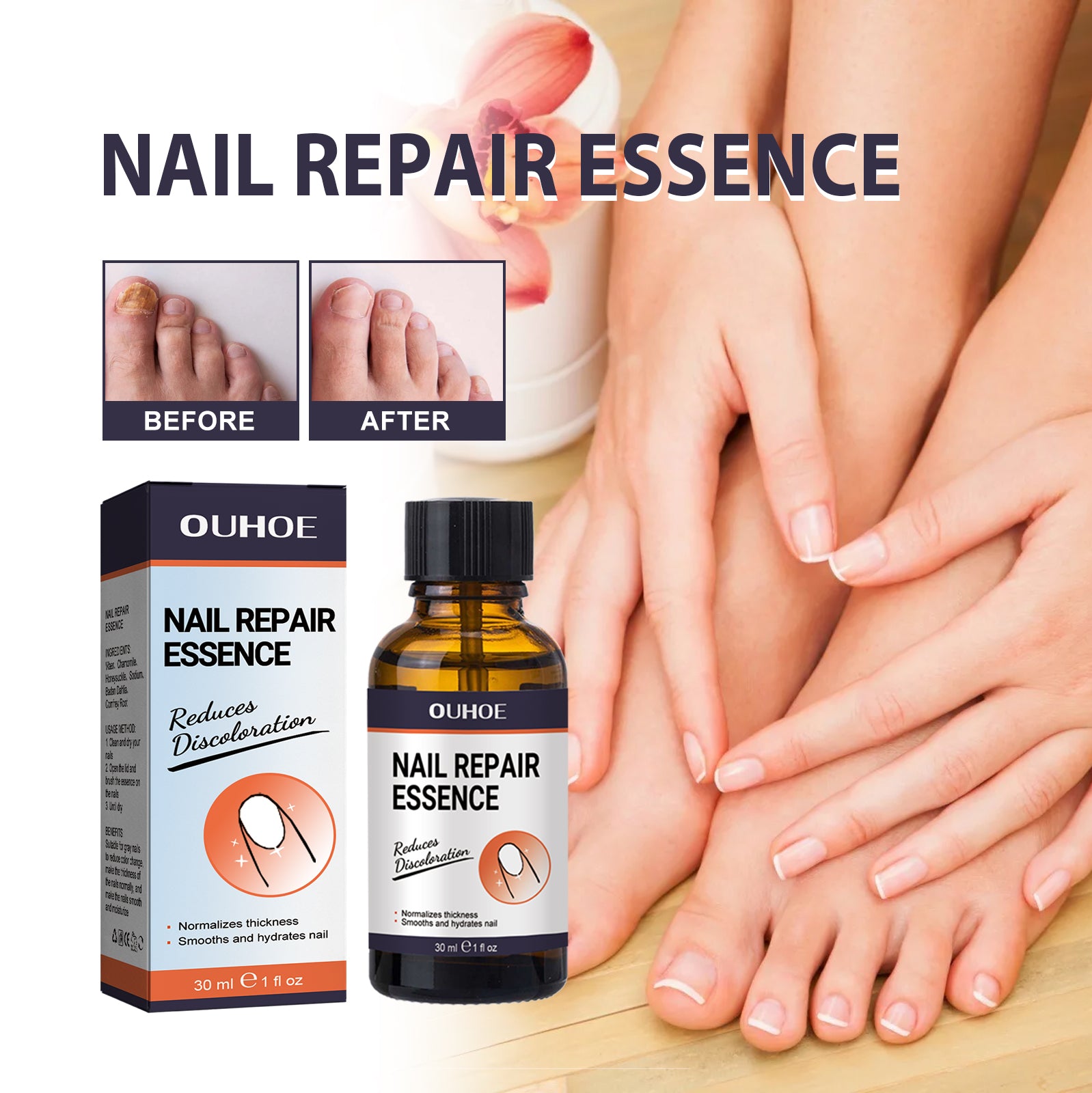 Nail Repair Essence, Soft Nail Thickening Nails Smooth Ingrown Toenails Grey Nails Repair Essence Health Eprolo https://www.cyberehub.com