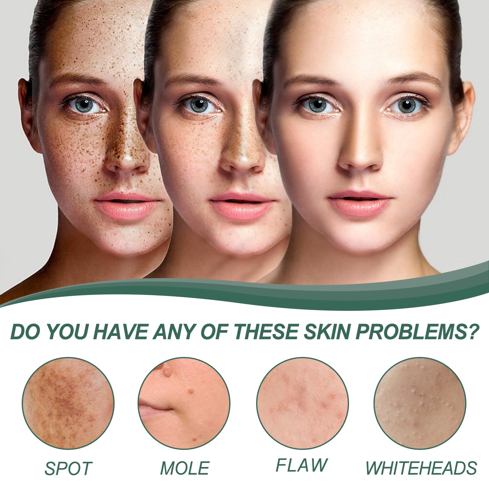 Herbal Natural Spot & Mole Cream, Blemishes Hydrating Whitening Brightening Cream Health Eprolo https://www.cyberehub.com