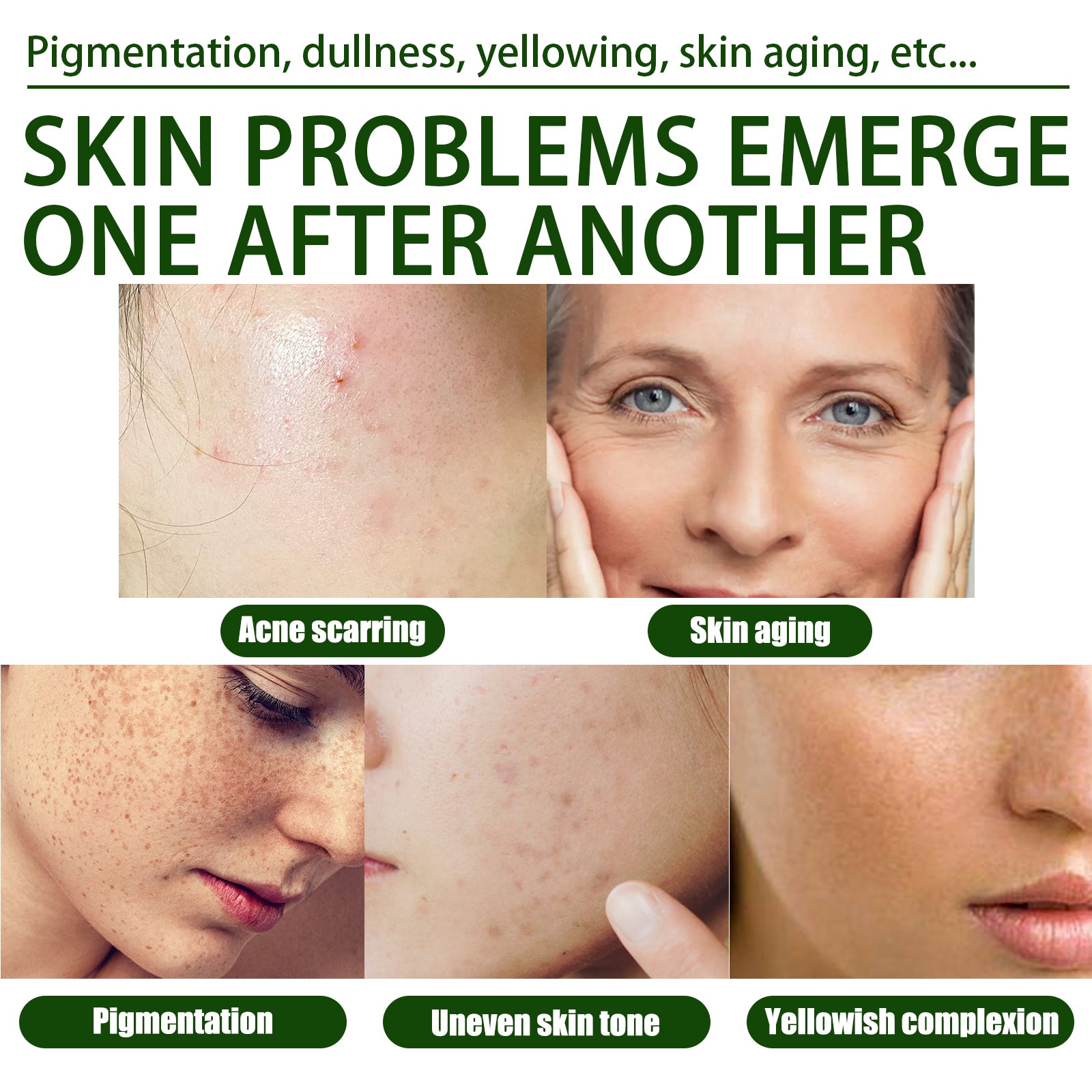 Olive Acne-Clearing Essence, Lightening Acne Mark Removing Closed Mouth Acne Dark Skin Repair Essence Health Eprolo https://www.cyberehub.com
