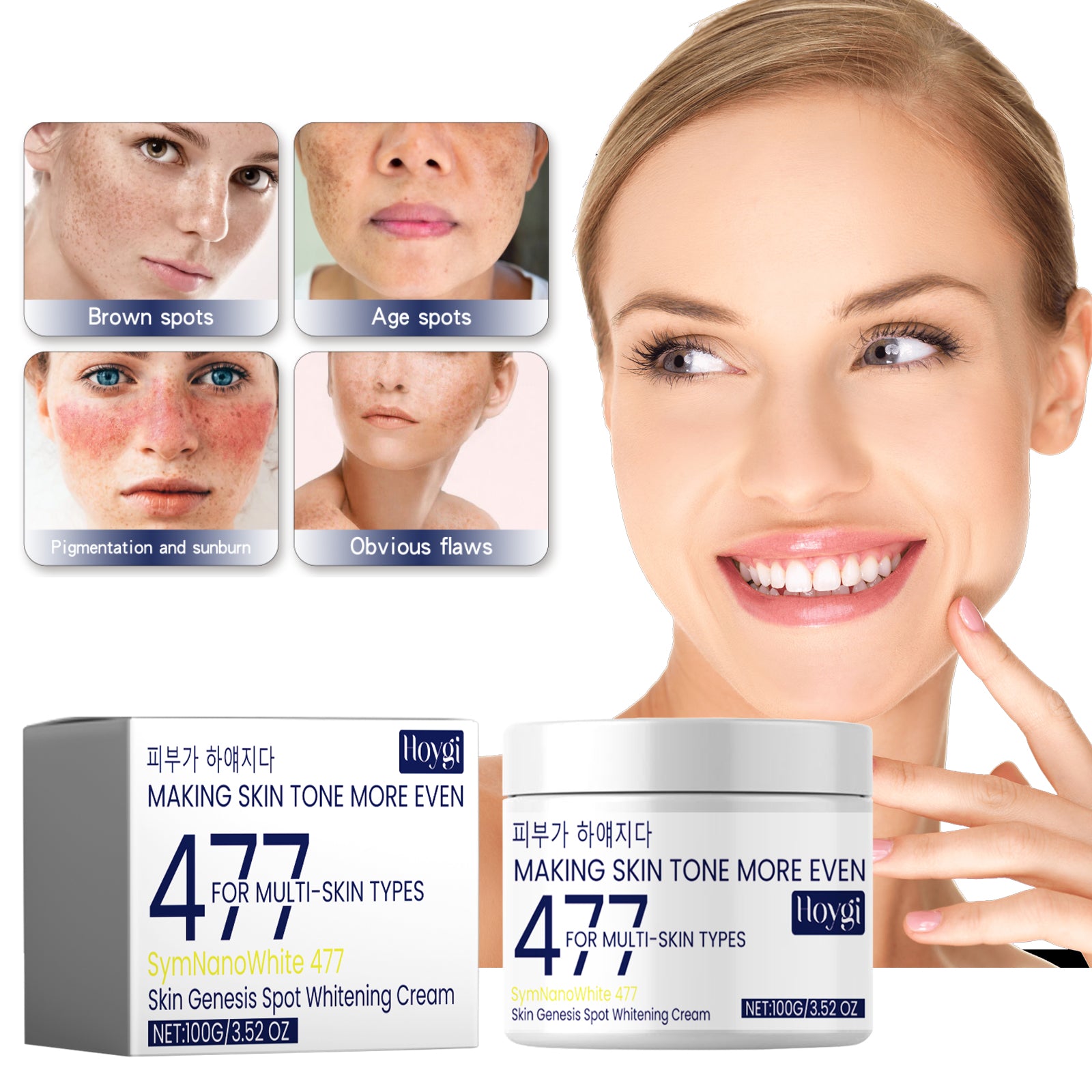 Skin Genesis Spot Whitening Cream, Dilute Spots Smooth Skin Bright White Color This Delicate Skin Moisturizing Cream Health Eprolo https://www.cyberehub.com