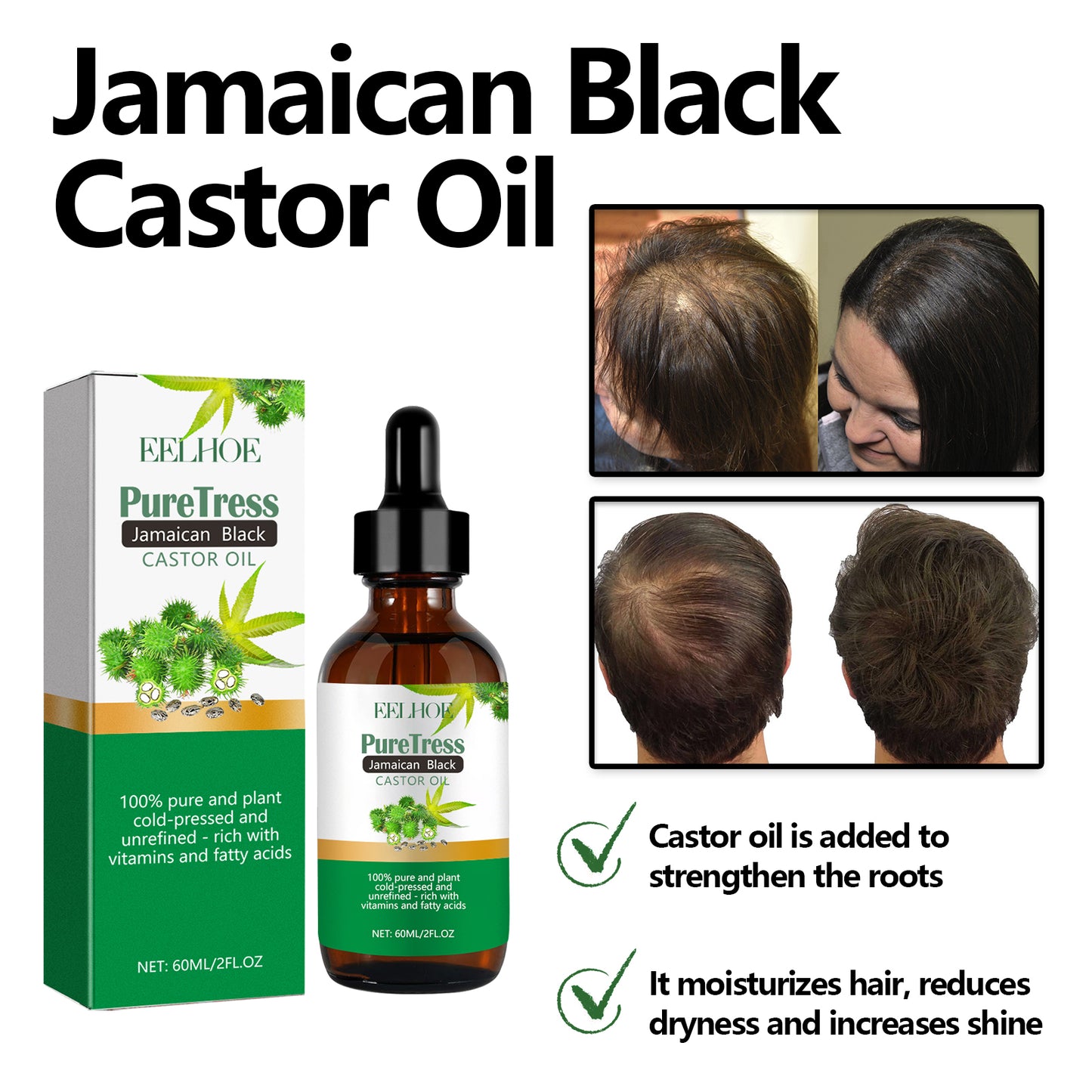 Jamaican Black Castor Oil, Moisturize Scalp And Prevent Dry Hair Thick And Solid Hair Beautiful And Shiny Easy To Absorb Essential Oils Health Eprolo https://www.cyberehub.com