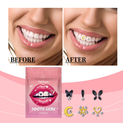 Crystal Dental Drill, Personality Sparkle Stylish Dental Accessories Enhance Smile Easily Use Decorative Dental Drill EELHOPE eprolo https://www.cyberehub.com