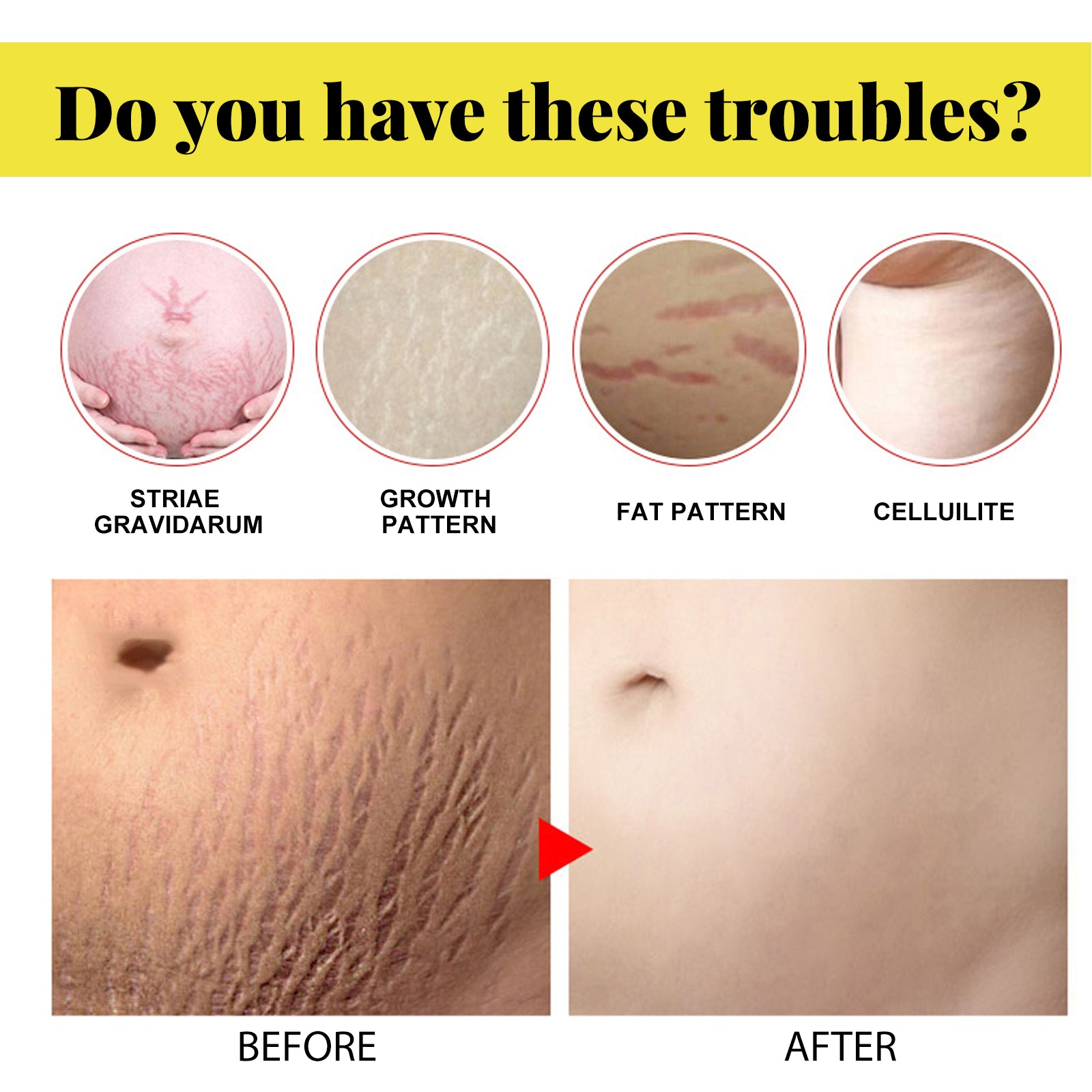 Skin Care Cream, Pregnant Women's Body Skin Gentle Repair Daily Care Moisturizing Moisturizer Health Eprolo https://www.cyberehub.com