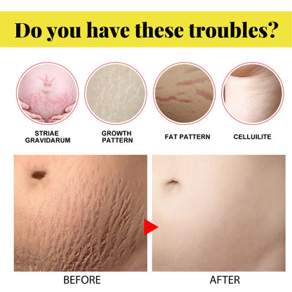 Skin Care Cream, Pregnant Women's Body Skin Gentle Repair Daily Care Moisturizing Moisturizer Health Eprolo https://www.cyberehub.com