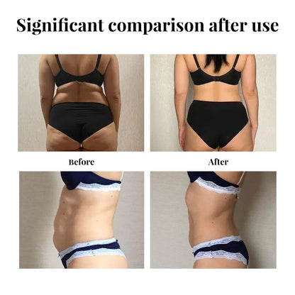 EELHOE Belly Lift Tape, Lifts Loose Skin Tighten Shape Slim Belly Button Tape Health Eprolo https://www.cyberehub.com
