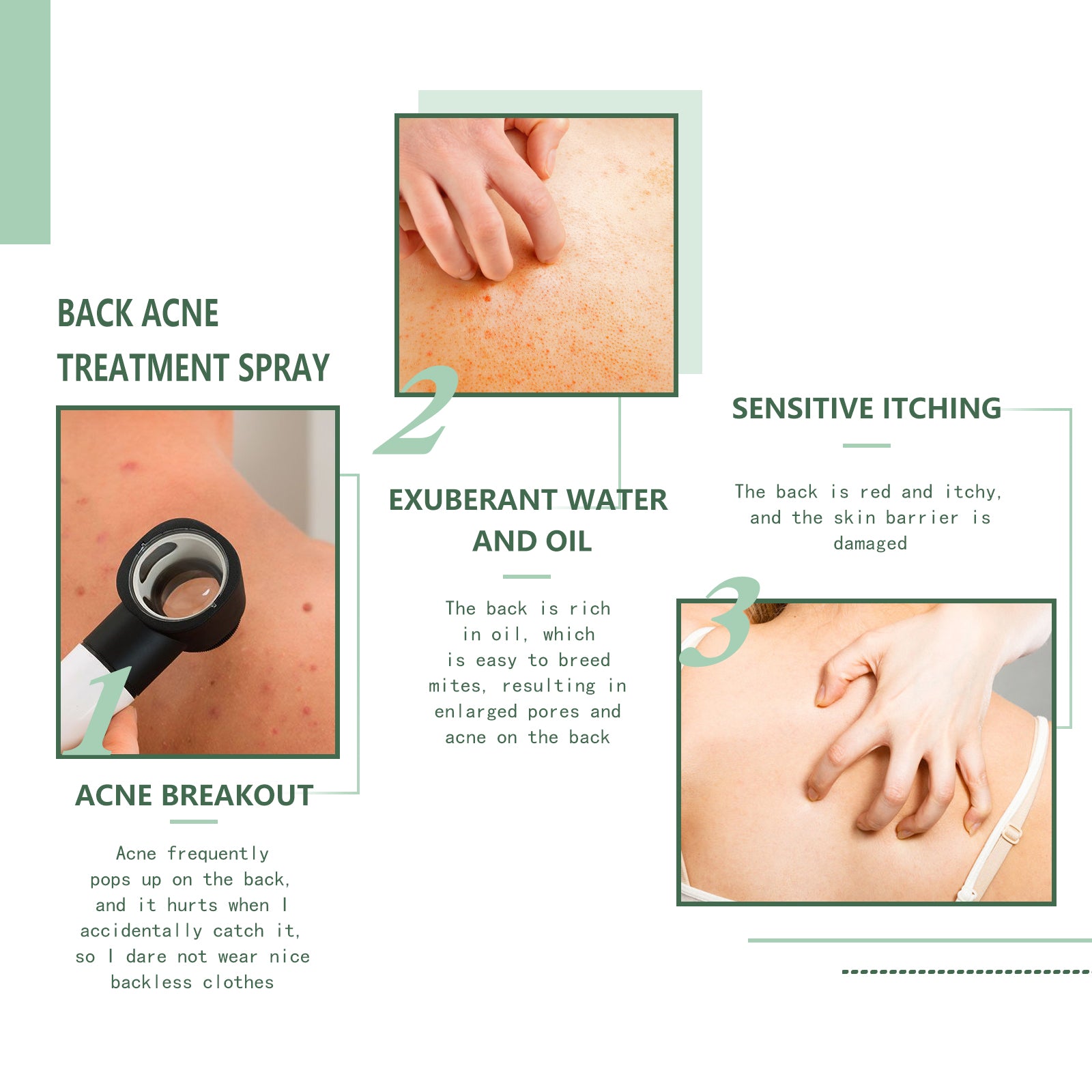 Body Acne Removal Cleanser Spray, Deep Clean Back Arm Fade Acne Beauty Moisturizing Spray Health & Beauty Health Eprolo https://www.cyberehub.com