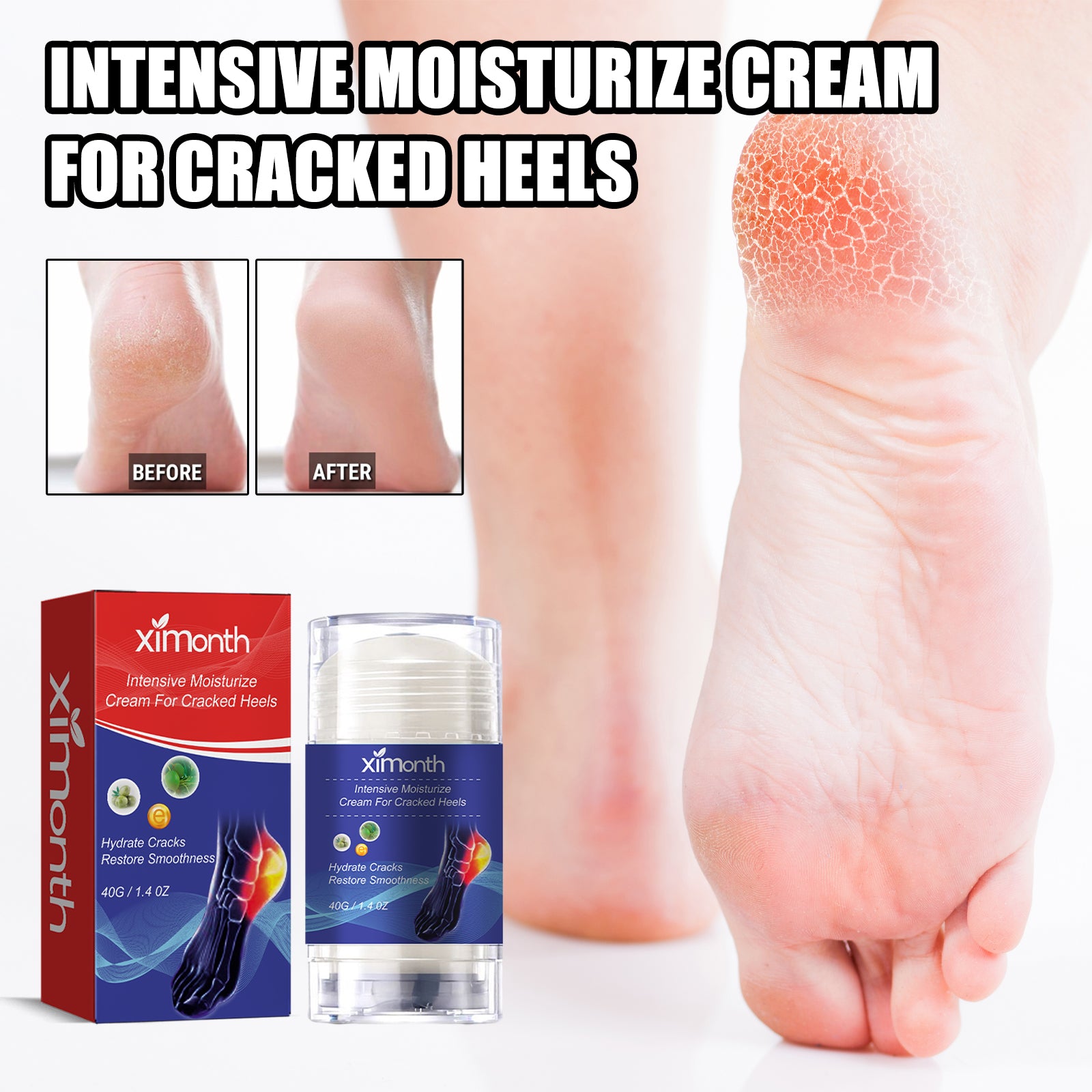 Heel Repair Cream Cleanses Dead Heel Calluses, Prevents Cracking And Peeling, And Moisturizes Foot Care Cream Health Eprolo https://www.cyberehub.com
