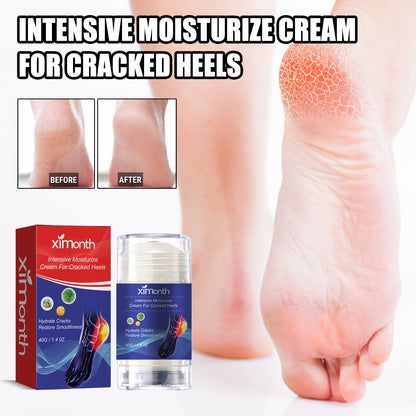 Heel Repair Cream Cleanses Dead Heel Calluses, Prevents Cracking And Peeling, And Moisturizes Foot Care Cream Health Eprolo https://www.cyberehub.com