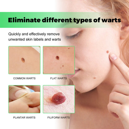Skin Tag Removal Rubber Band, Remove Moles Remove Warts Face Neck Flesh Granule Body Cleansing Soap Health Eprolo https://www.cyberehub.com
