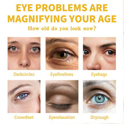 Vitamin E Eye Cream, Lightened Dark Circles Crow's Feet, Firmed And Moisturized Eye Cream Health Eprolo https://www.cyberehub.com