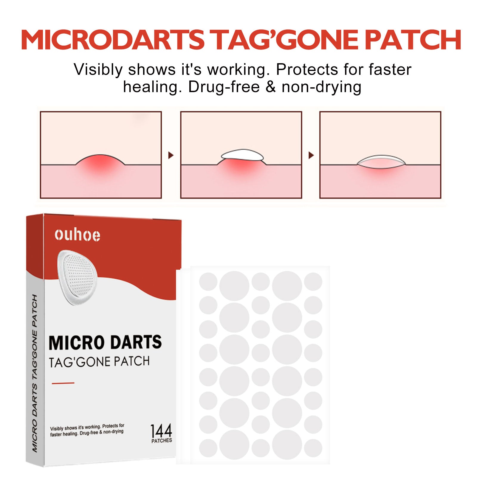 Acne Patch, Skin Clean Acne Pimple Moles Gram Wart Corns Spot Patch Health Eprolo https://www.cyberehub.com