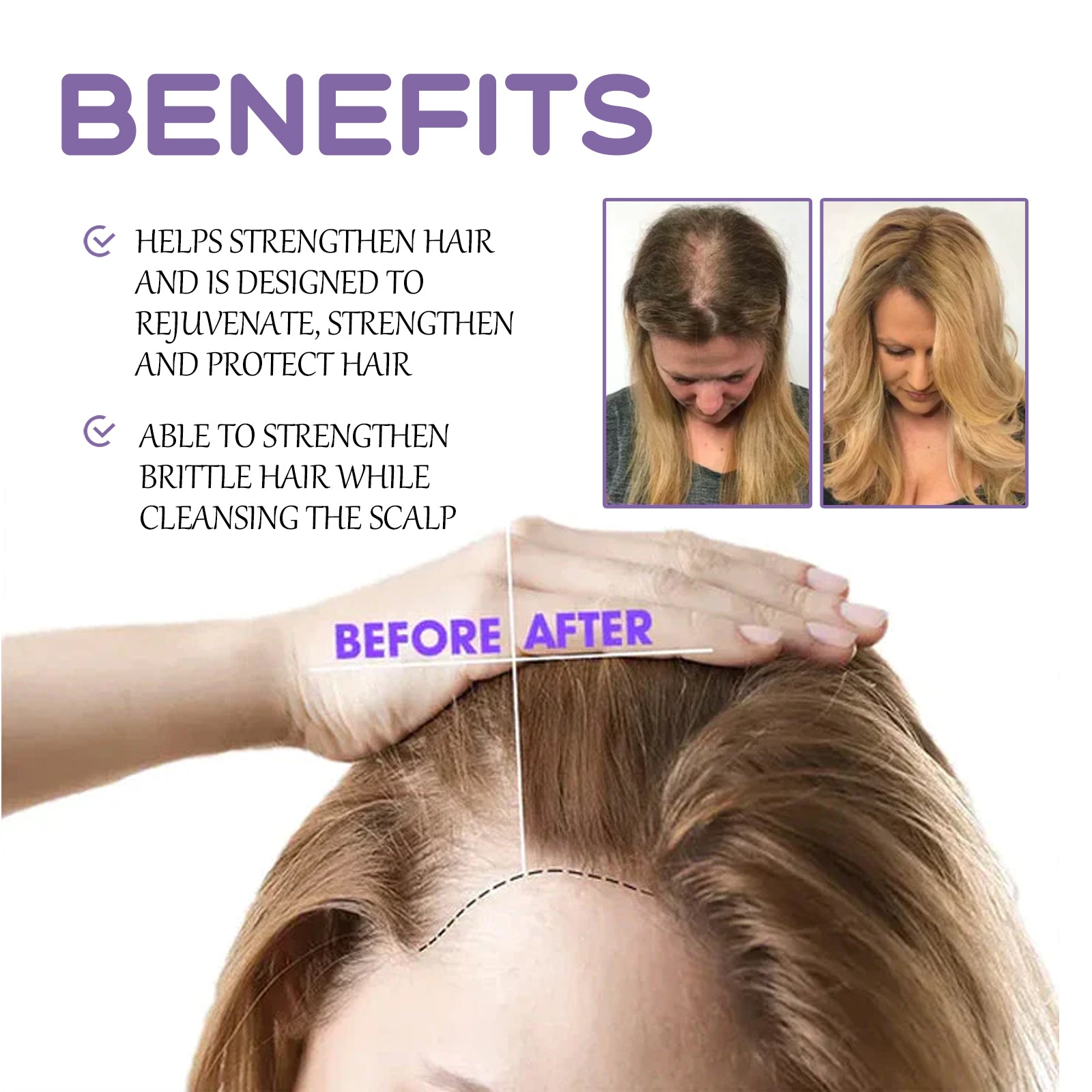 Hair Follicle Dense Hair Drops Repair Hair Follicle Nourishing Hair Roots Dense Solid Hair Care Health Eprolo https://www.cyberehub.com