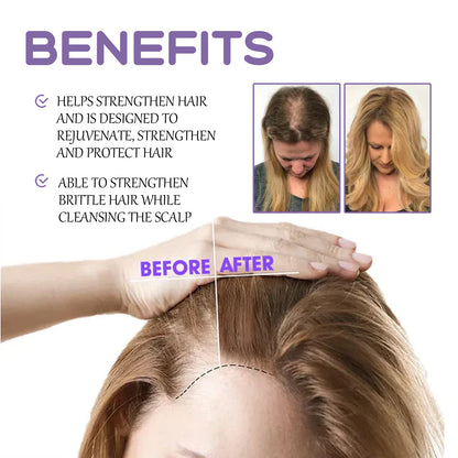 Hair Follicle Dense Hair Drops Repair Hair Follicle Nourishing Hair Roots Dense Solid Hair Care Health Eprolo https://www.cyberehub.com