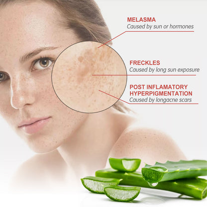 Speckle Corrector Cream, Lighten Spots And Wrinkles Repair Dull Skin Hydrating Brightening Cream Health Eprolo https://www.cyberehub.com
