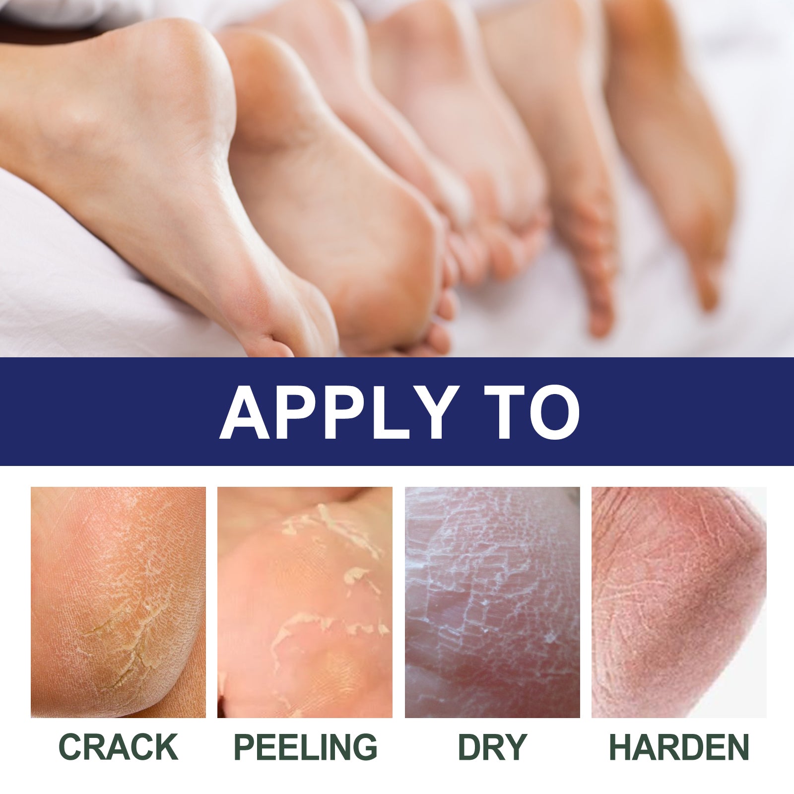 Cracked Heel Ointment, Repair Heel Calluses And Foot Moisturizing Anti-Cracking Peeling Care Health & Beauty Health Eprolo https://www.cyberehub.com