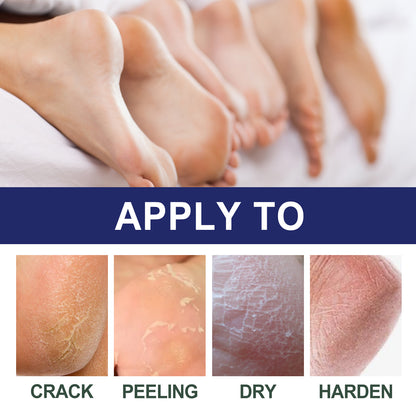 Cracked Heel Ointment, Repair Heel Calluses And Foot Moisturizing Anti-Cracking Peeling Care Health & Beauty Health Eprolo https://www.cyberehub.com