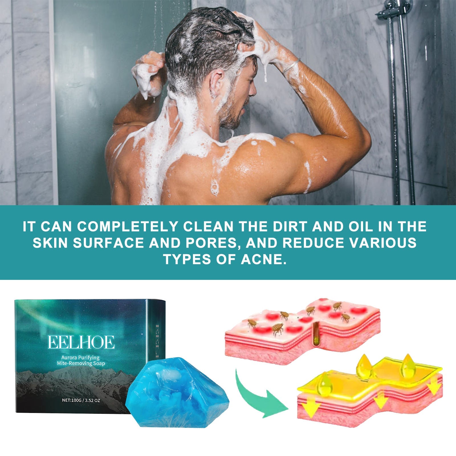 Deep Cleansing Facial Body Skin Lightening Acne Acne Print Multi-effect Cleansing Soap Health & Beauty Health & Beauty Under 10 UniversalMaax https://www.cyberehub.com