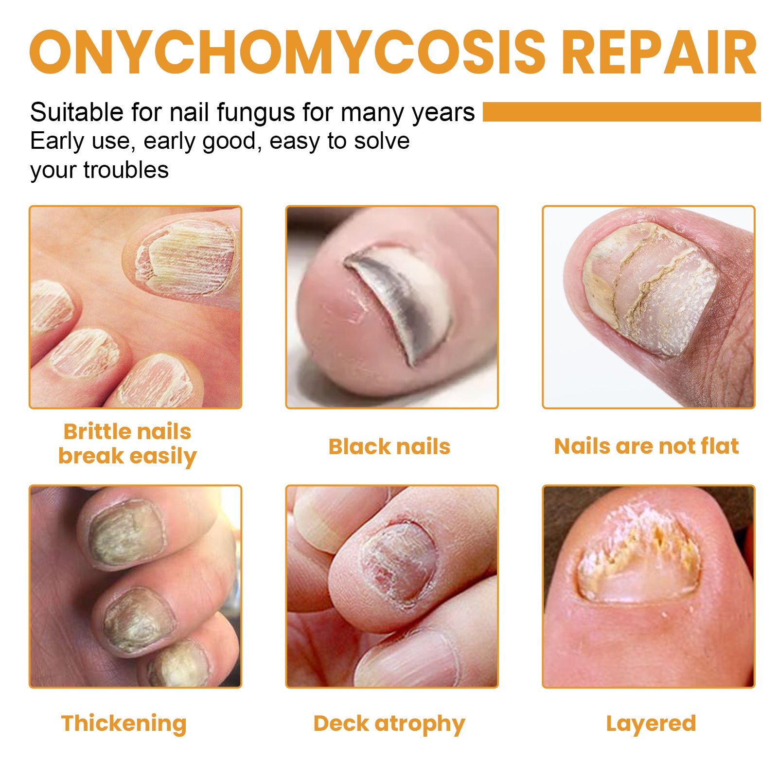 Fungal Nail Patches, Repair Nail Thickening Grey Nail Soft Nail Shine Nail Care Patch Health & Beauty Health Eprolo https://www.cyberehub.com