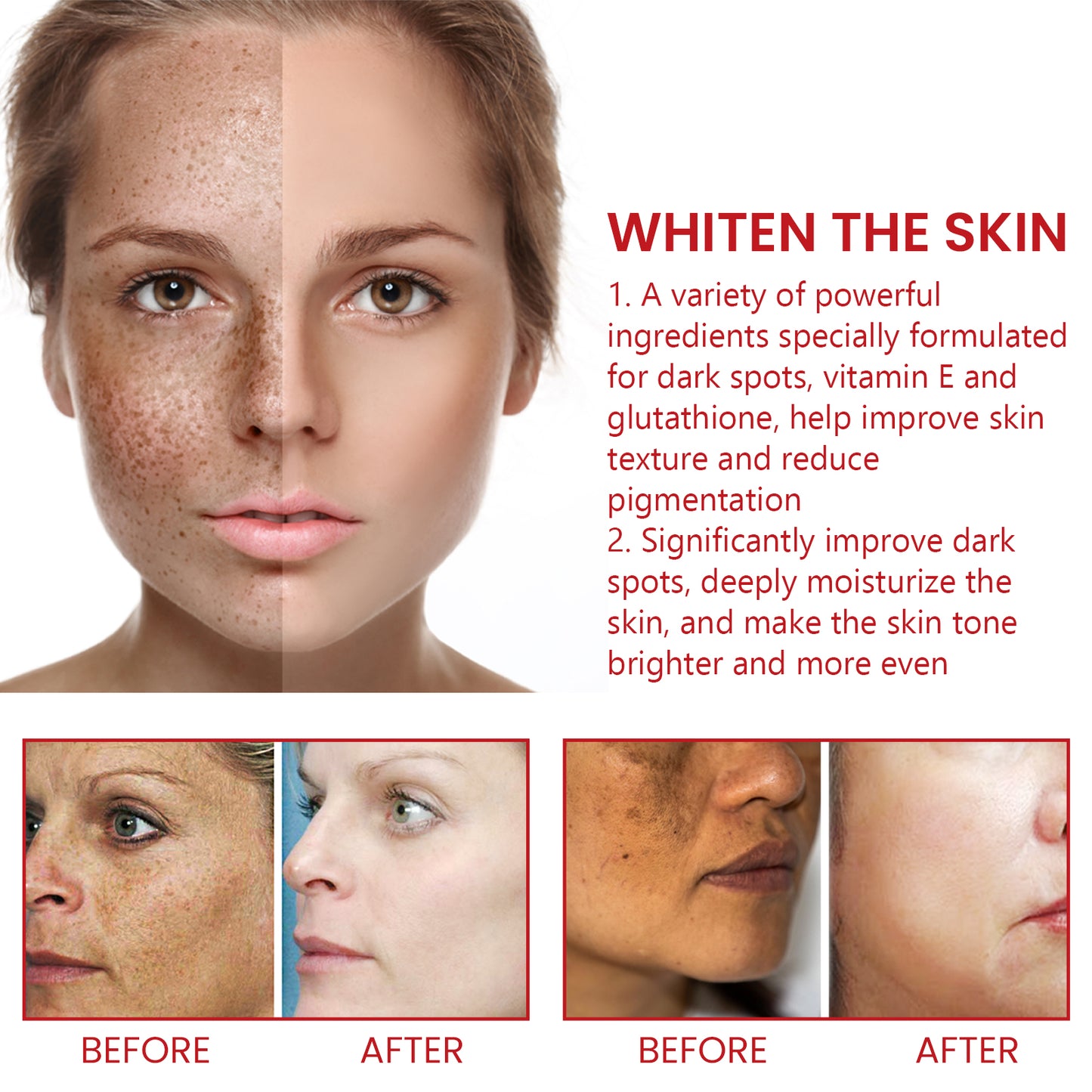 Dark Spot Repair Cream, Restores Dull Skin, Lightening Fine Lines And Dark Spots, Brightening Skin Repair Cream Health Eprolo https://www.cyberehub.com