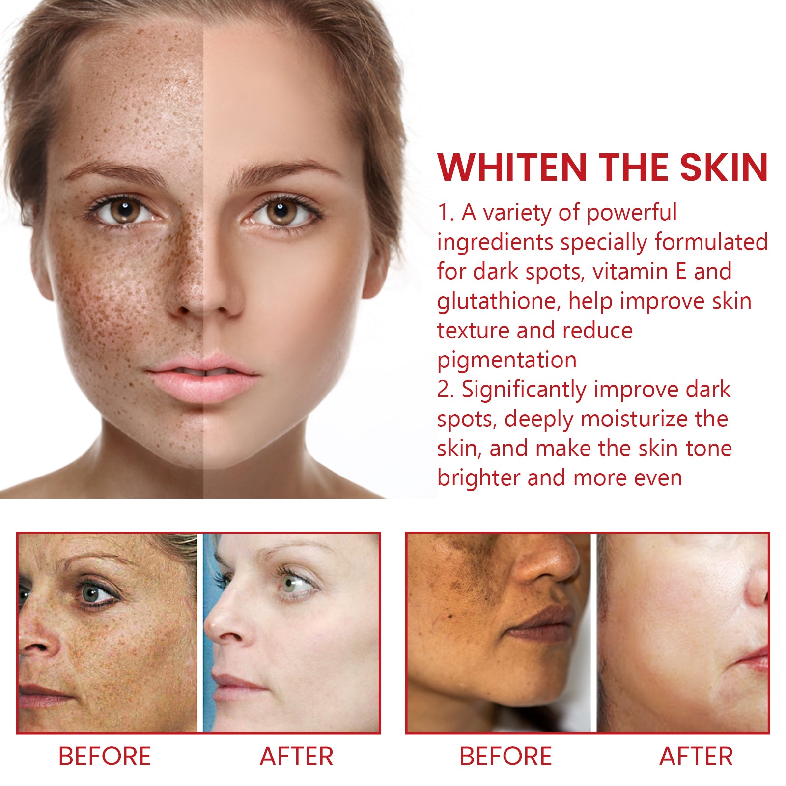 Dark Spot Repair Cream, Restores Dull Skin, Lightening Fine Lines And Dark Spots, Brightening Skin Repair Cream Health Eprolo https://www.cyberehub.com