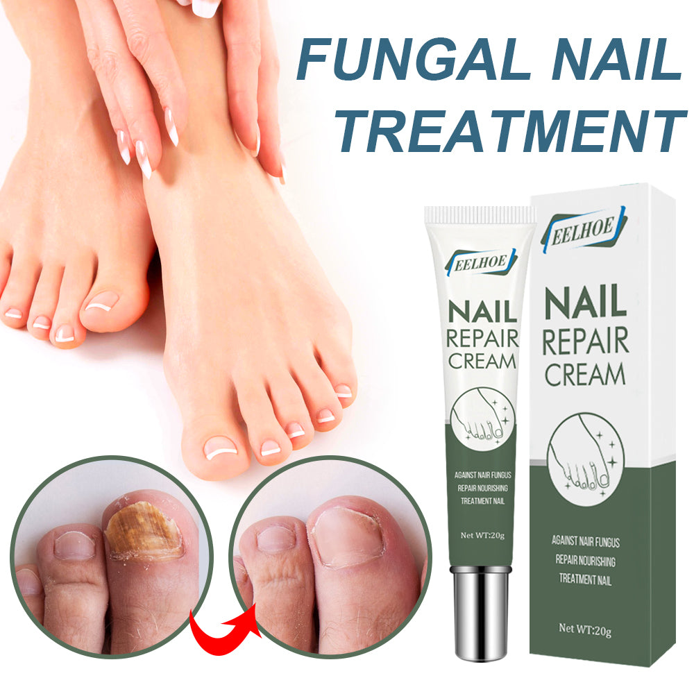 Foot Care And Thickening Nail Repair Cream. Nail Repair Cream Health Eprolo https://www.cyberehub.com