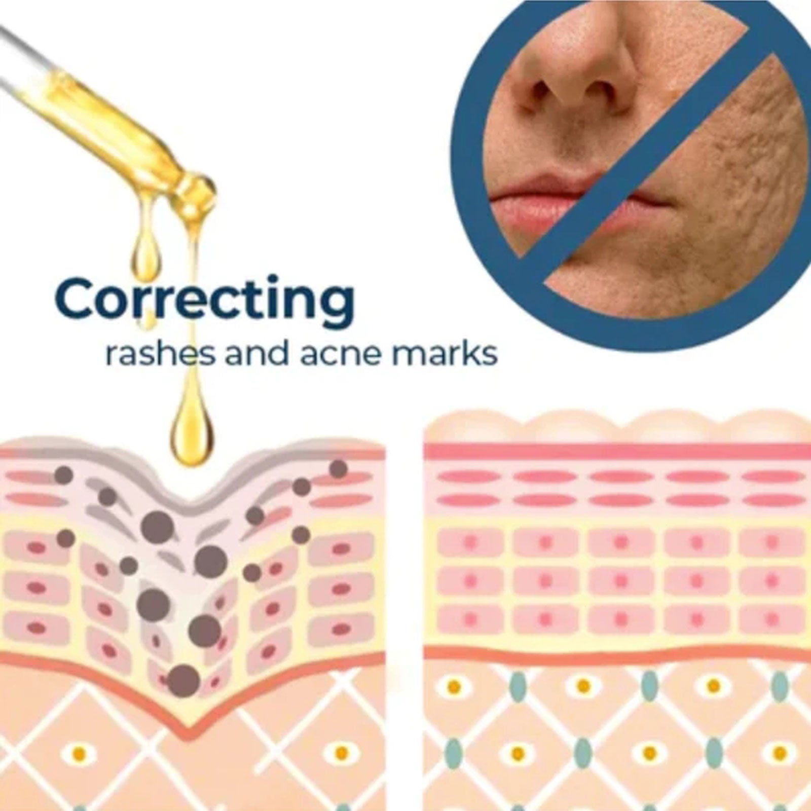 Turmeric Whitening Spot Serum, Lighten Freckle Spots Brightening Skin Hydrating Serum Health Eprolo https://www.cyberehub.com