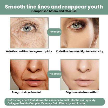 Collagen Anti-Aging Serum, Hydrates Reduces Fine Lines And Firming Skin Care Essence Health Eprolo https://www.cyberehub.com