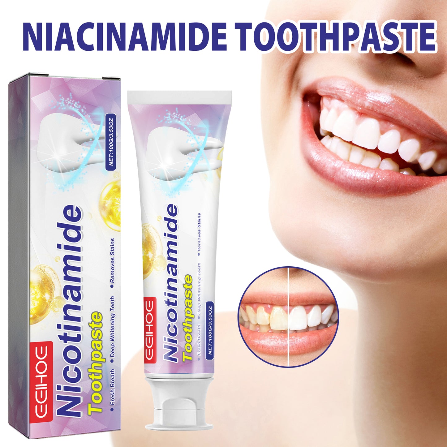 Niacinamide Toothpaste, Cool White Toothpaste Freshen Breath Clean Mouth Guard Gum Jianchi Bright White Toothpaste Health Eprolo https://www.cyberehub.com