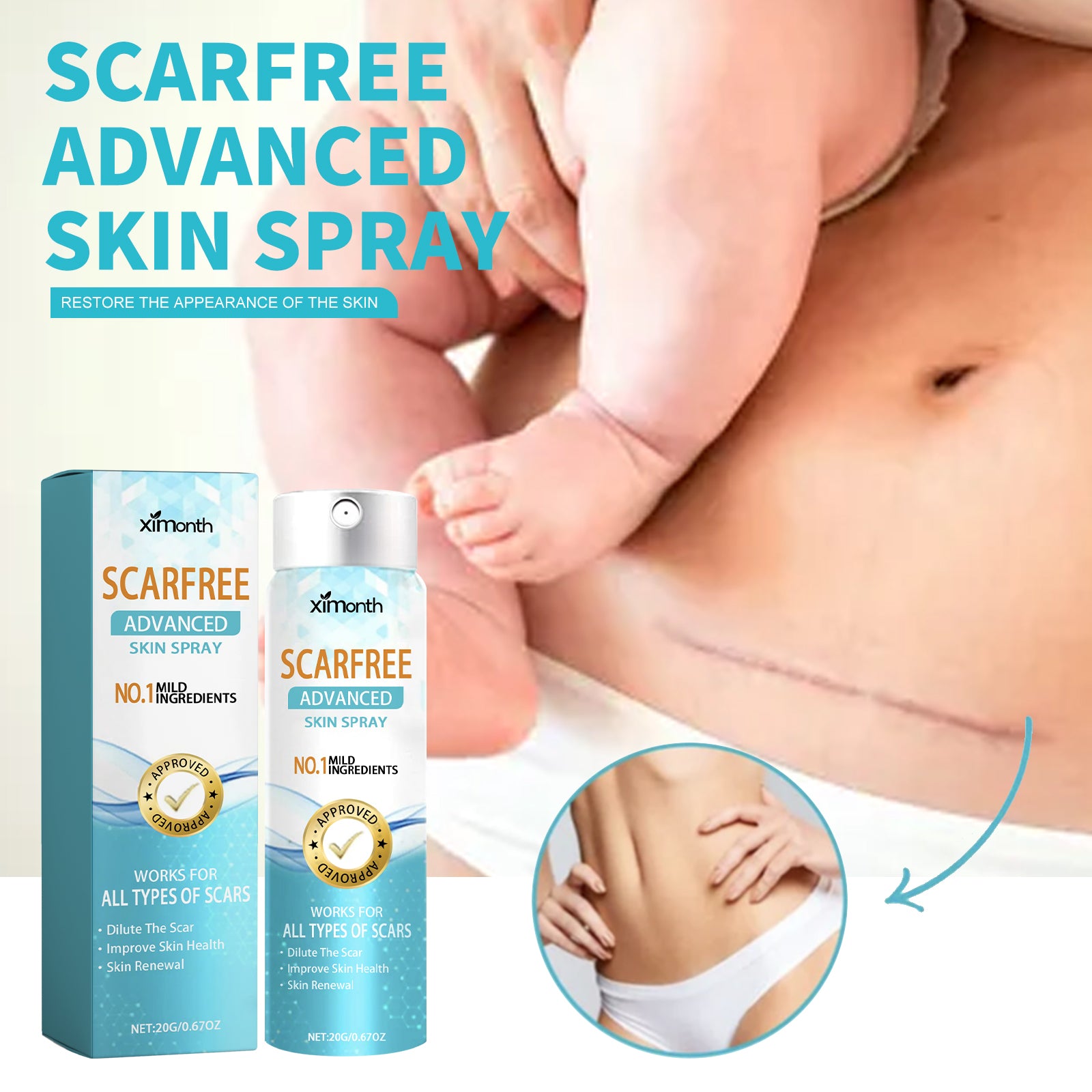 Scarfree Advanced Skin Spray, Body Skin Care Reduces Post-Natal Scars And Smooths Skin Health & Beauty Health Eprolo https://www.cyberehub.com