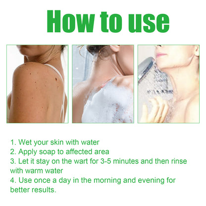 Mole Remover Soap, Repair Meat Granules Corns And Dark Moles, Smooth Skin Anti-wart Cleansing Soap Health Eprolo https://www.cyberehub.com