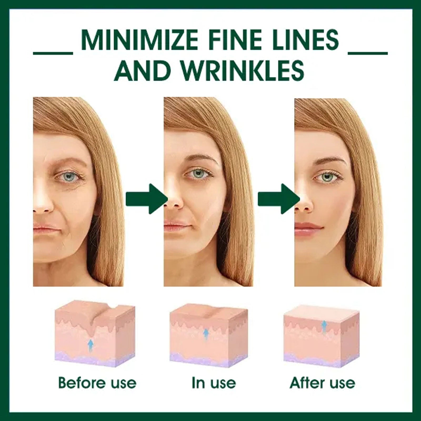 EELHOE Facial Essence, Lifts And Tightens Facial Skin And Reduces Fine Lines And Wrinkles Health Eprolo https://www.cyberehub.com