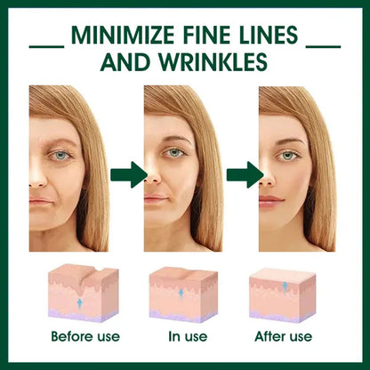 EELHOE Facial Essence, Lifts And Tightens Facial Skin And Reduces Fine Lines And Wrinkles Health Eprolo https://www.cyberehub.com