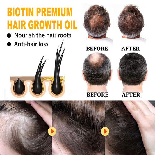EELHOE Biotin Hair Treatment Oil Deeply Moisturizing Scalp Massage Treatment Thick And Smooth Hair Care Oil Health Beauty CJ USa USPS Muqe https://www.cyberehub.com