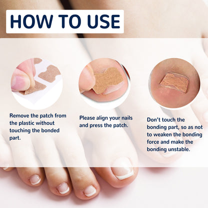 Nail Correction Patch, Nail Insert Correction And Repair Toe Manicure Nail Patch Health Eprolo https://www.cyberehub.com