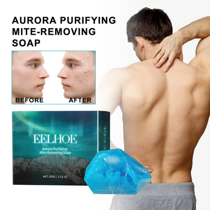 Deep Cleansing Facial Body Skin Lightening Acne Acne Print Multi-effect Cleansing Soap Health & Beauty Health & Beauty Under 10 UniversalMaax https://www.cyberehub.com