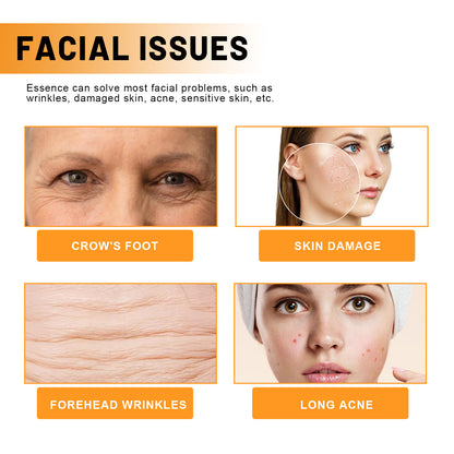 Face Essence Reduces Fine Lines, Brightening Facial Tone, Moisturizing And Hydrating Skin Essence Health Eprolo https://www.cyberehub.com
