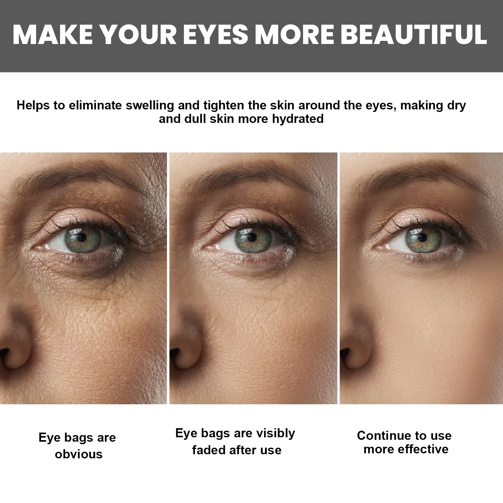 Collagen Hyaluronic Acid Massager Eye Cream For Fine Lines And Delicate Skin Care Eye Cream Health Eprolo https://www.cyberehub.com