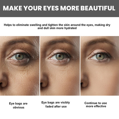Collagen Hyaluronic Acid Massager Eye Cream For Fine Lines And Delicate Skin Care Eye Cream Health Eprolo https://www.cyberehub.com