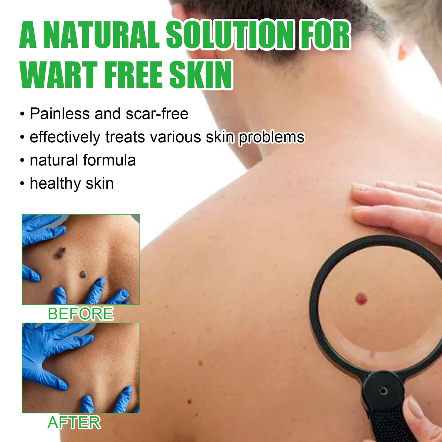 Mole Remover Soap, Repair Meat Granules Corns And Dark Moles, Smooth Skin Anti-wart Cleansing Soap Health Eprolo https://www.cyberehub.com