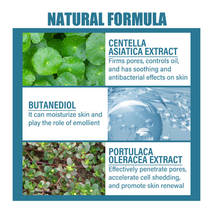 AHA Hydrolytic Extract, Smooths Fine lines, Tights Pores, Moisturizes Brightening And Repairing Skin Essence Health Eprolo https://www.cyberehub.com