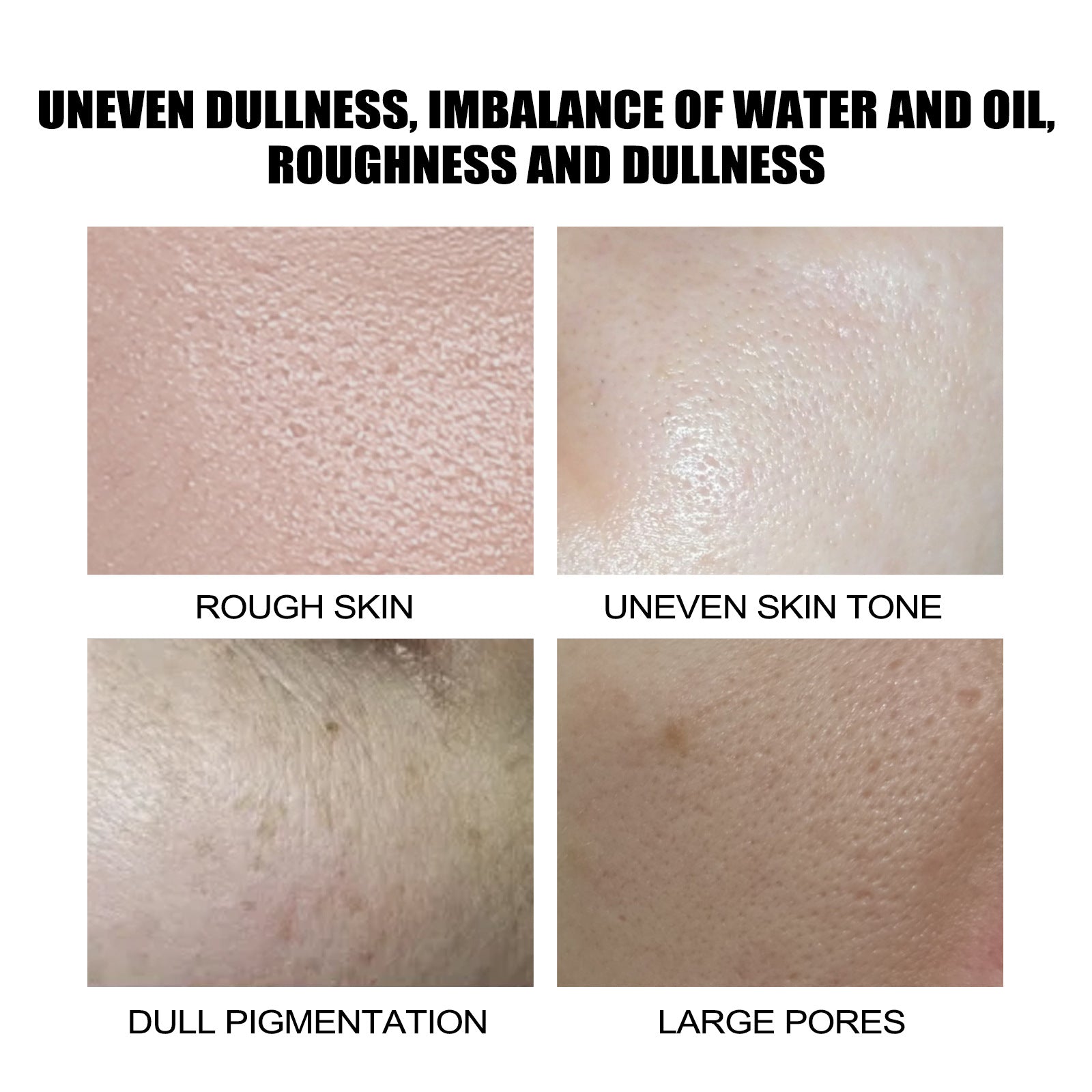 Instant Facial Moisturizing Essence, Lighten Wrinkles, Moisturize, Firming And Brightening Essence Health Eprolo https://www.cyberehub.com