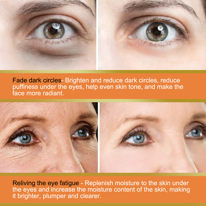 Revive + Glow Vitamin C Eye Balm, Dark Circles Repair Moisturizing Firming Eye Cream Stick Health Eprolo https://www.cyberehub.com