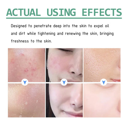 Green Tea Cleansing Mud Mask, Facial Cleansing Moisturizing Whitening Skin Blackhead Acne Removing Mud Mask Health & Beauty Health Eprolo https://www.cyberehub.com