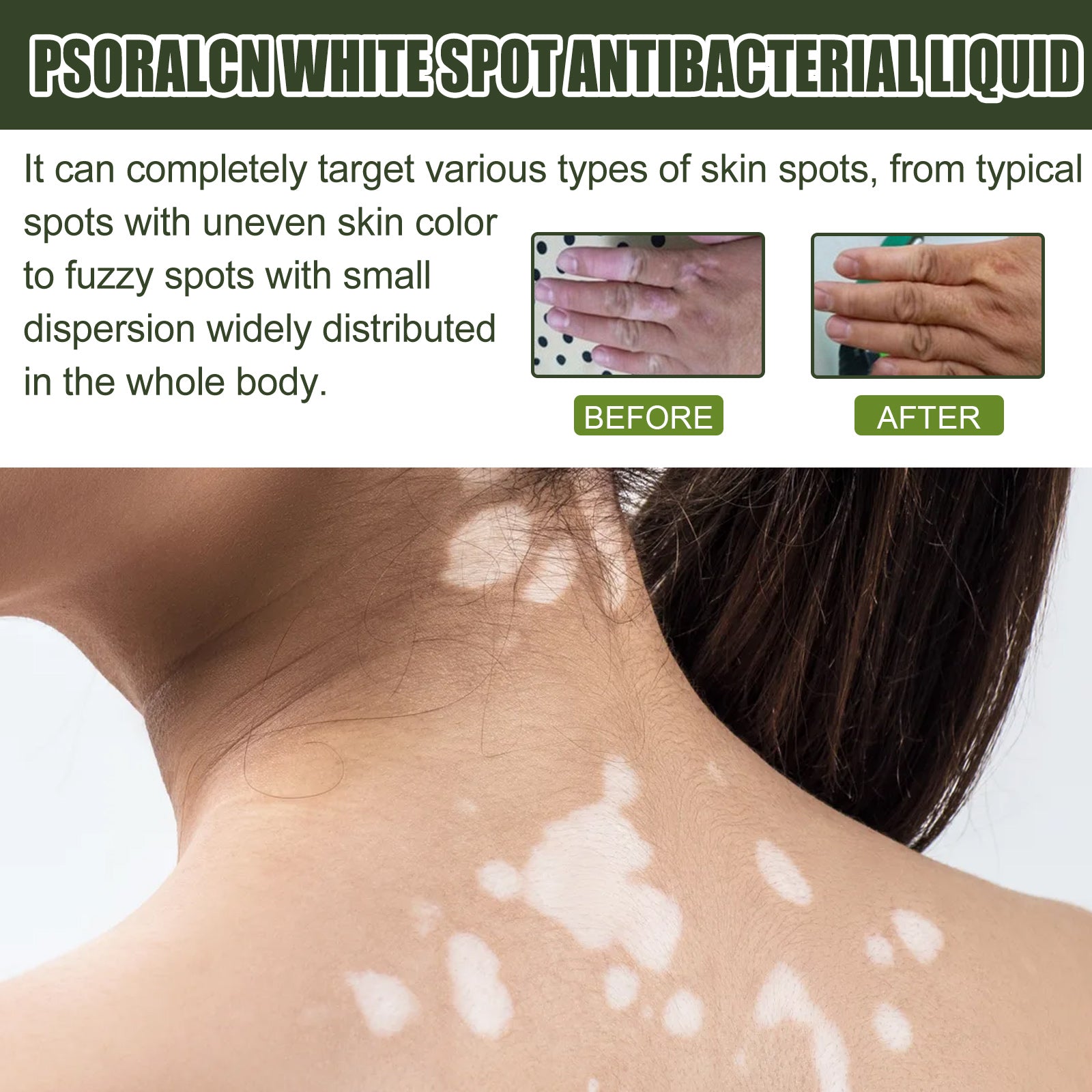 White Spot Purifying Serum For Whitening And Repairing White Spot Spot And Perspiration Spot Skin Moisturizing Serum Health & Beauty Health Eprolo https://www.cyberehub.com