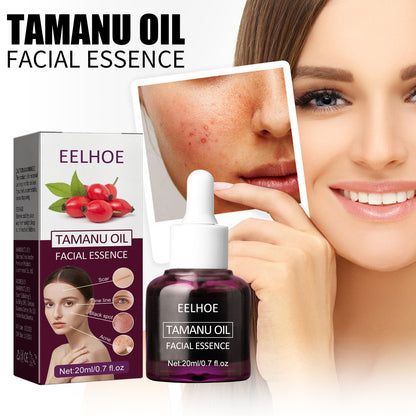 Tamanu Facial Oil, Relieves Acne Marks Fine Lines Moisturizes and Firms Skin Essential Oil default title Health Eprolo https://www.cyberehub.com