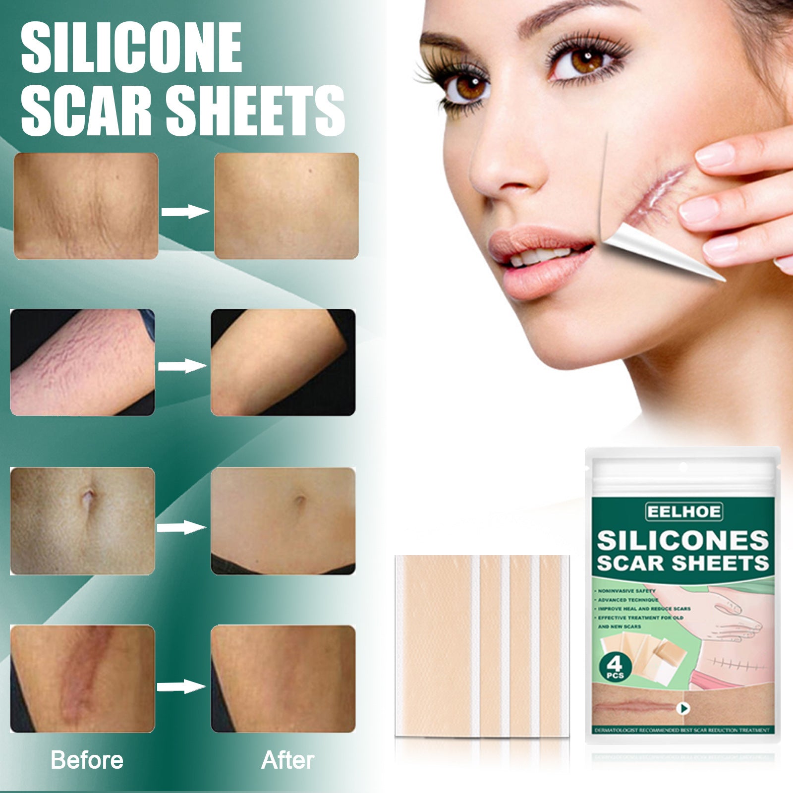 Silicone Gel Repair Patch, Fade Marks Transparent Care Skin Repair Patch Health Eprolo https://www.cyberehub.com