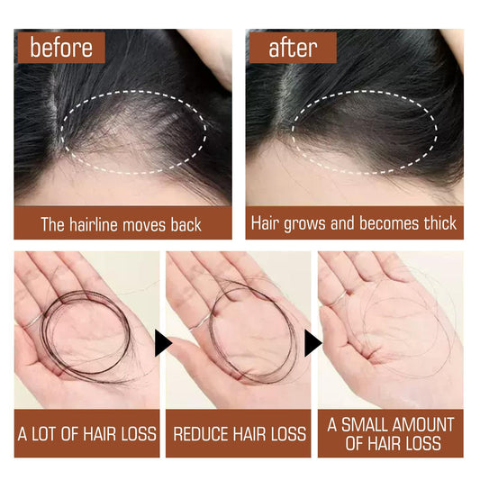 Batana Oil From Honduras - Get Fuller, Thicker, Healthier Hair - Great Gifts For Women Men Conditioner Haircare Silky - Hair Nutrition Health Beauty CJ USa USPS Muqe https://www.cyberehub.com