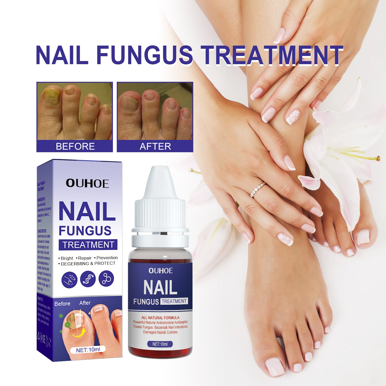 Nail Repair Lotion, Repair Thickening Nail Inlay Gray Nail Shine Soft Nail Care Solution default title Health Eprolo https://www.cyberehub.com